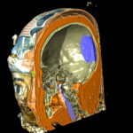 Mumienkopf mit einem mediansagittalen Schnitt