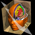 VOXEL-MAN Gehirn und Schädel 3D-Atlas
