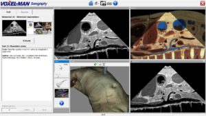 Training im abdominalen Ultraschall mit Zielansicht (unten rechts) und interaktiv erzielter Ansicht (oben)